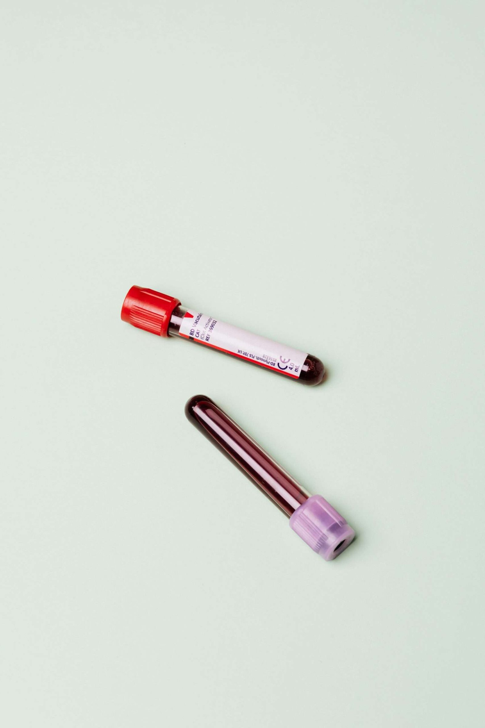 Bloodwork testing for weight loss.